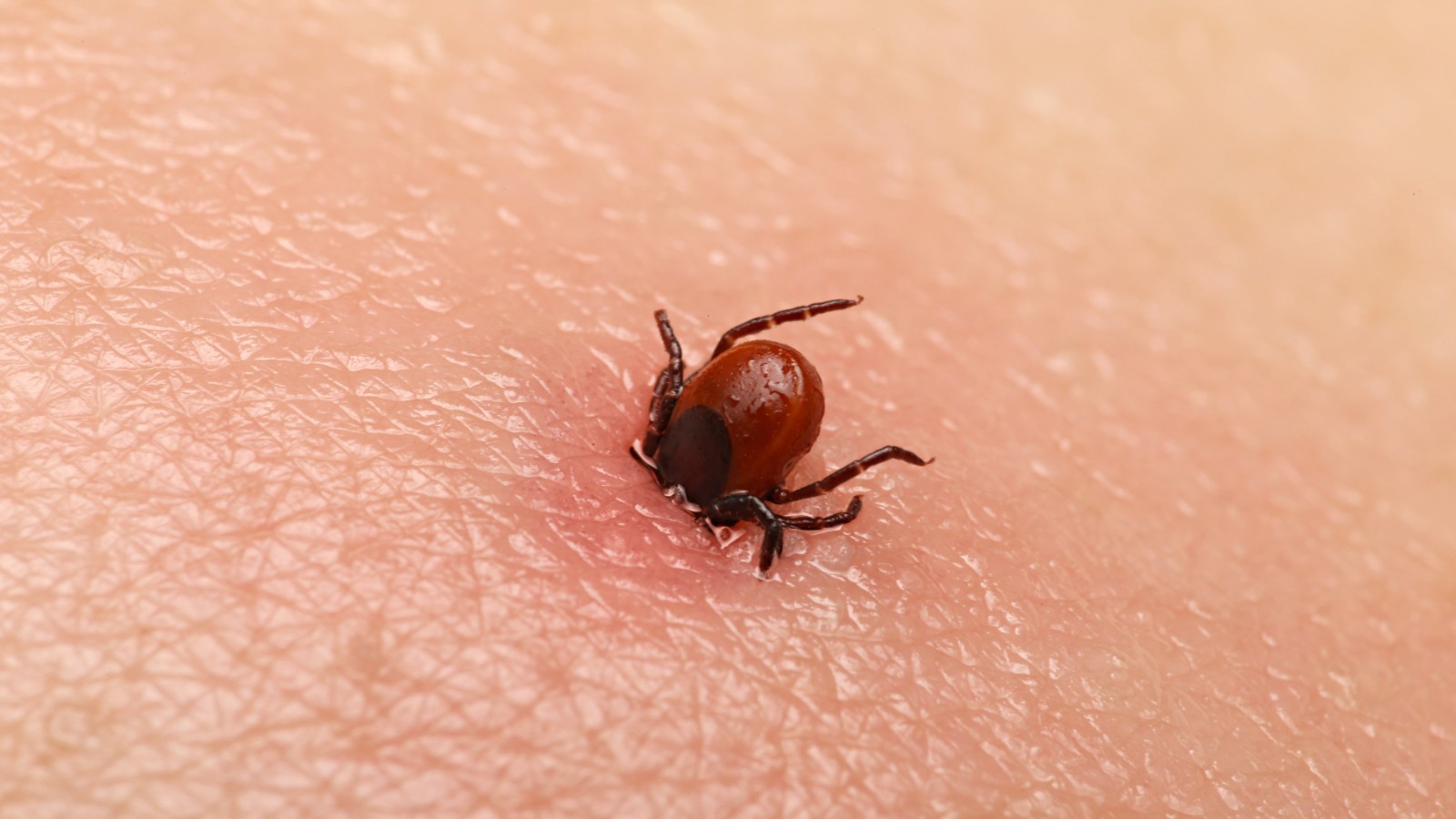 A close-up of a tick with its head embedded in human skin